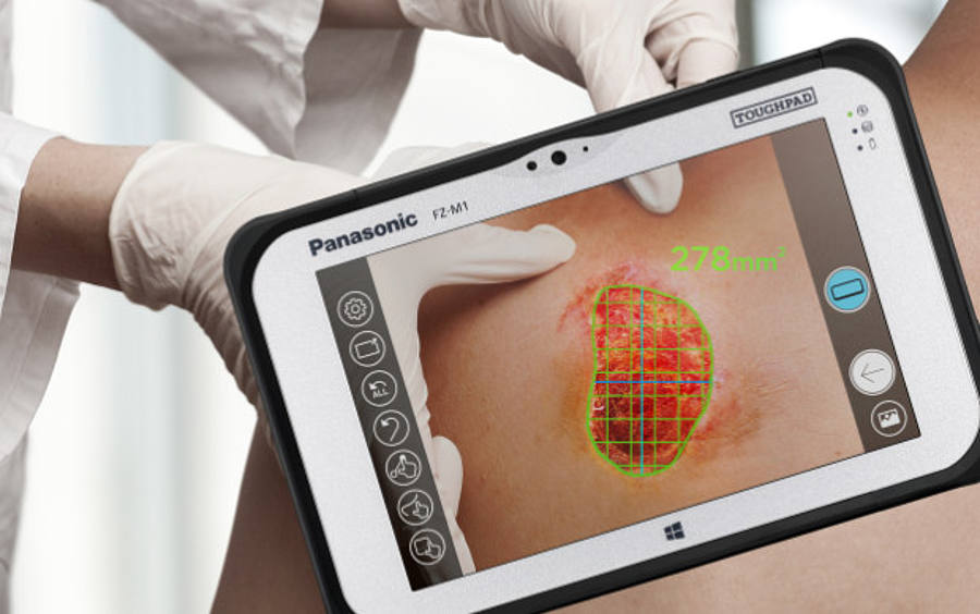 Das FZ-M1-Tablet kann beispielsweise zur Überwachung der Wundheilung eingesetzt werden.