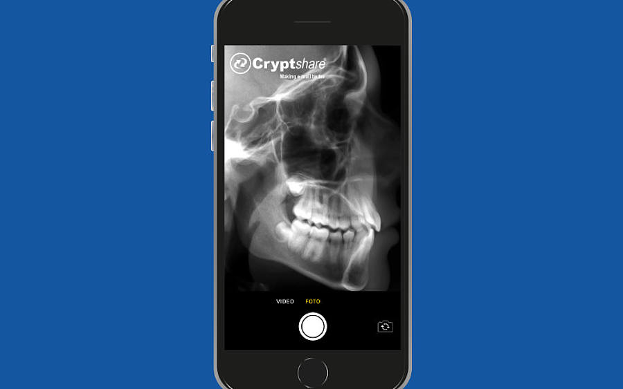 Übertragung eines Röntgenbildes per App