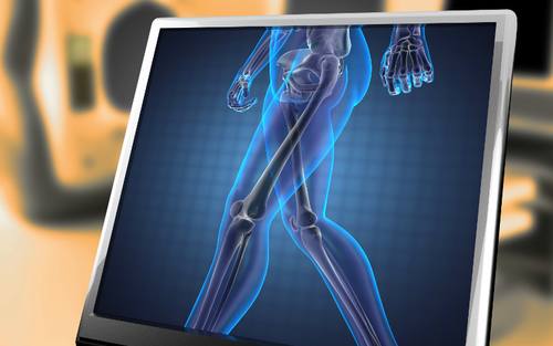 Implantate auf dem 3D-Drucker