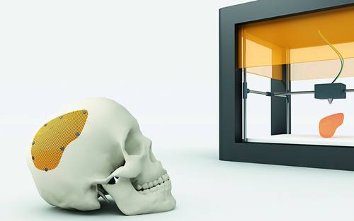 3D-Drucker